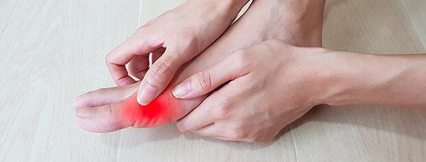Early Signs And Symptoms Of Bunion
